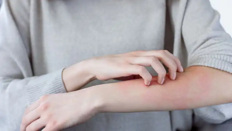 Cilt Kanseri Belirtileri: Dermatologdan Kaçırılmaması Gereken İpuçları