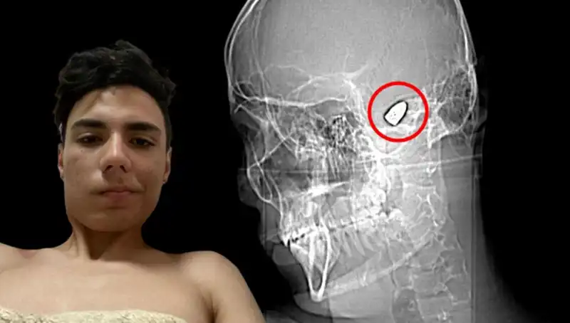 Beyin Tümörü Tanısıyla Yaşayan Genç Kadının Mücadelesi